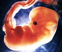 fetus-human-6week.jpg